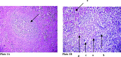 Plate 1 Effect of sodium fluoride on histoarchitecture of splenic nodule in rat. Hematoxylin and eosin stain (100 X) (arrow in plate 1A indicates splenic nodule. In plate 1B arrow indicates derangement of splenic nodule (a) with collagen fibre infiltration (b), vaculation in organ structure (c) along with reticulin (d) and hyperpigmentation (e).
