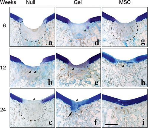 Figure 3. Histological findings after toluidine blue staining in the 3 groups at 6 weeks (a, d, g), 12 weeks (b, e, h), and 24 weeks (c, f, i) after implantation. Scale bar: 2 mm. Dotted line in (a): amorphous reparative tissue filling the subchondral region. Arrowheads in (b): faint toluidine blue staining that reflects involvement of endochondral ossification. Arrowhead in (c): toluidine blue-negative reparative tissue covering the defect. Dotted line in (c): reconstructed subchondral bone consisting of woven bone-like structure. Arrowhead in (d): toluidine blue-positive cartilaginous tissue. Arrowhead in (e): thin faintly toluidine blue-positive layer covering the defect. Arrowhead in (f): the unstained central region of the cartilaginous layer covering the defect. Arrow in (f): excessive cartilage extruding through the deficient tidemark. Dotted line in (g): woven bone-like subchondral bone already re-appearing at 6 weeks. Arrowhead in (h): reconstructed tidemark distinctly discriminating the articular cartilage from the subchondral bone.