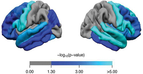 Figure 3. Comparison of cortical thickness between ALS patients (n = 456) and healthy controls (n = 294). Analyses were corrected for age and sex. Regions with a significantly lower cortical thickness are marked in blue (p < 0.05, Bonferroni-corrected). p-values were mapped onto the surface of the entire region of interest (ROI, 34 per hemisphere) to indicate significant regional differences between ALS patients and controls.