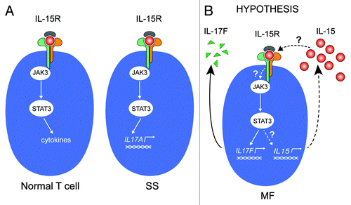 Figure 1. IL-15 signaling in CTCL (A) Left: In normal T cells, IL-15R activates the Jak3/STAT3 pathway, which can result in specific cytokine secretion. The specific cytokine(s) expressed depends on the activation and differentiation status of the T-cell type in question. Right: In malignant T cells from Sézary syndrome patients, IL-15 activates the Jak3/STAT3 signaling pathway, which, in turn, initiates transcription of the gene encoding IL-17A. (B) In MF it is unknown whether (1) the constitutive activation of the Jak3/STAT3 is induced by IL-15; and (2) STAT3 drives the constitutive transcription of IL-15. In other words, whether IL-15 is part of an autocrine stimulation loop involving the Jak3/STAT3 pathway and downstream target genes IL-17F and IL-15.