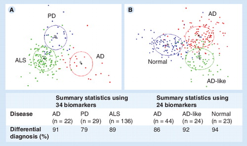 Figure 2. Differential diagnostics through multivariate biostatistics of blood serum concentrations of groups of proteins using quantitative 2D gel electrophoresis.Disease-specific discrimination was accomplished using both canonical discriminant analysis (top) and linear discriminant analysis (bottom), showing discrimination between patients with AD, PD and ALS (A) and patients with AD, AD-like and normal controls (B).AD: Alzheimer’s disease; ALS: Amyotrophic lateral sclerosis; PD: Parkinson’s disease. Data from Citation[14,15].