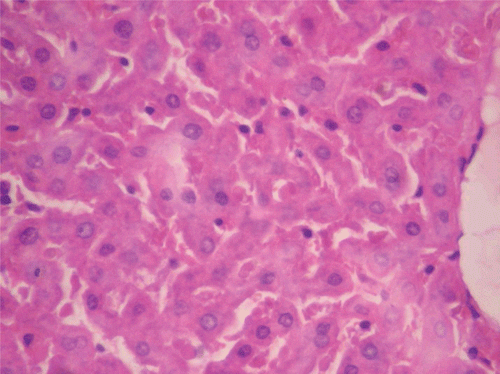 Figure 5.  Histopathologic presentation of male rat liver of CF 80 mg/kg group (Congested; 400×).