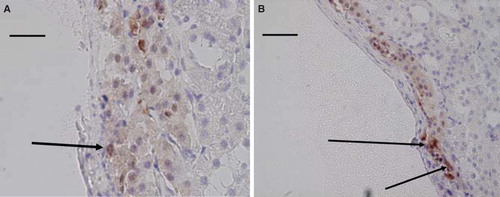 Figure 2. Light micrographs of islet transplants under the renal capsule 1 month (A) and 8 months (B) after transplantation. The sections were immunohistochemically stained for the presence of PGP 9.5 and counterstained with hematoxylin. A neuron (arrow) can be seen in A, and a blood vessel with positive nerves in the adventitia in B. Scale bar 100 µm in A and 200 µm in B.