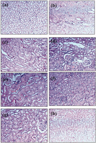 Figure 6. Microscopic images of kidney sections under light microscope (40×) after haematoxylin and eosin staining from animals of (a) normal control, (b) Sham control of combination ABCD, (c) Sham control of combination ABD, (d) methotrexate treated animals, (e) nephrotoxic rats treated with ABCD at a dose of 200 mg/kg, (f) nephrotoxic rats treated with ABCD rats at a dose of 300 mg/kg, (g) nephrotoxic rat treated with ABD combination at a dose of 250 mg/kg and (h) nephrotoxic rats treated with Neeri KFT tablet at a dose of 100 mg/kg.
