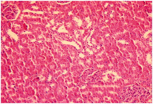 Figure 2. Kidney of rat administered colistin in doses of 150,000 IU/kg/day for 7 days showing mild tubular damage with vacuolisation (HE × 100).