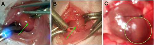Figure S1 Construction of MI models on C57/BL6 mice.Notes: (A) Exposure of LAD (green arrow) through a 2 cm incision at the left lateral costal rib. (B) Permanent ligation of LAD (green arrow) with an 8-0 silk suture. (C) Ischemia was confirmed by visual inspection of blanching in the myocardium distal to the site of occlusion (green circle).Abbreviations: LAD, left anterior descending coronary artery; MI, myocardial infarction.