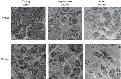 Figure 3.  Ultrastructural analysis of thymus and spleen. Electron micrograph (1000×) of thymus (upper panel) and spleen (lower panel) from control C57BL/6J mice injected SC (daily, for 60 days) with PBS (n = 4) or d-galactose (50 mg/kg BW; see Figure 1 legend for details) (n = 4), and from aged (24-month-old) control mice (n = 3). 70-nm ultrathin sections of both thymus and spleen were stained with uranyl acetate and lead stain solution, observed with a TEM, and photographed at 1000×. The images here are from a representative mouse from each of the indicated regimens.