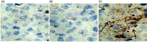 Figure 6. Immunohistochemical images (40×) of CRT expression following melanoma therapy via the MTO formulations. (A) No treatment; (B) the MTO solution and (C) the MTO cubic phase. The arrows in the images indicate the sites of CRT expression.
