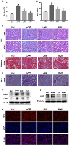 Figure 1. MgH2 ameliorates APAP-induced renal dysfunction, histological injury and oxidative stress in mice.(A, B) The levels of SCr and BUN in serum of mice were determined by corresponding kits.(C–E) The renal histological changes in mice were observed by HE staining (C), Masson staining (D) and PAS staining (E).(F, G) The protein expressions of NGAL, KIM-1 and iNOS in kidneys of mice were detected by western blotting.(H) The intracellular ROS level in renal tissues of mice was detected using DHE.The results were expressed as mean ± SEM. Statistical comparisons were performed using a Newman–Keuls test (*p < 0.05 vs. Control group, #p < 0.05 vs. APAP group).