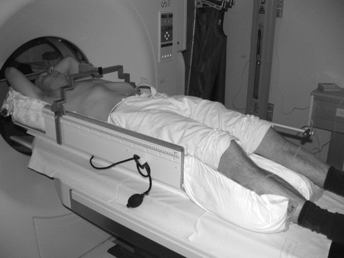 Figure 1.  Patient immobilization using Lax-Blomgreen stereotactic body frame.