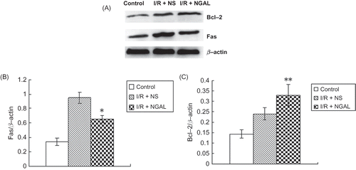 Figure 5. Immunoblot analysis of Fas and Bcl-2 proteins (A). The density of band was quantified. Values presented are ratios of Fas or Bcl-2 to beta-actin, which was used as an equal protein loading marker (B and C). Results are presented as mean ± SD (n = 5); *p < 0.05, versus IR + NS group; **p < 0.05, versus IR + NS group.