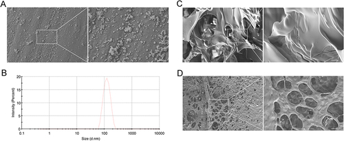 Figure 2 The Characterization of ES NPs-HA. SEM images of the esketamine-encapsulated PLGA nanoparticles (A) Scale bar: 500 nm; Particle size distribution of esketamine-encapsulated PLGA nanoparticles (B); SEM images of hyaluronic acid hydrogel (C) Scale bar: 5 μm; SEM images of ES NPs-HA (D) Scale bar: 5 μm.