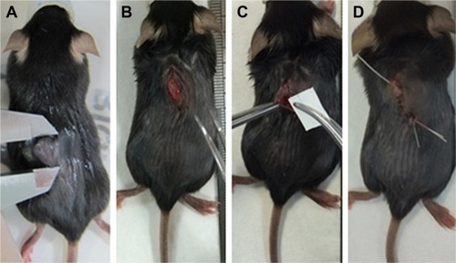 Figure 2 Experimental procedure of the deployment of the andrographolide-eluting membranes.Notes: (A) A rat bearing the tumor. (B) An incision was made. (C) Implantation of nanofibrous membrane. (D) Wound was closed by sutures.