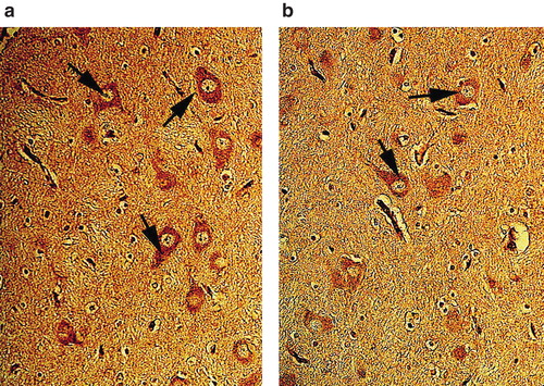Figure 6. Leakage of albumin into the neuropil of cerebral cortex in pig brain after cardiac arrest and treatment with vasopressin and adrenaline (VA group) (a) and vasopressin alone (V group) (b). Albumin leakage in the neuropil and neurons was considerably reduced in pigs treated with vasopressin alone in comparison with the group receiving vasopressin and adrenaline. ×300.