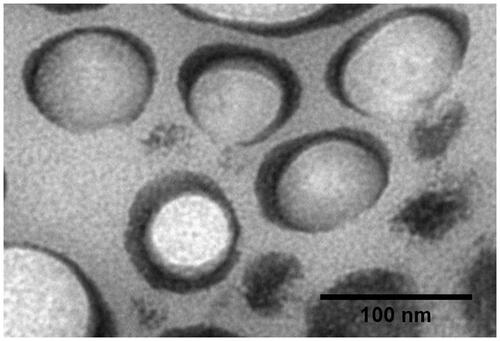Figure 2. Transmission electron microscopy of TS-loaded optimized formulation F4 contained SoyPC and NaDC in 5/1 ratio. Abbreviations: NaDC, sodium deoxycholate; SoyPC, soybean phosphatidylcholine; TS, telmisartan.