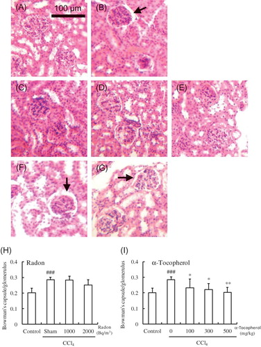 Figure 3. Effect of radon (H) and α-tocopherol (I) on CCl4-induced renal damage in mouse: (A) control, (B) CCl4, (C) α-tocopherol 100 mg/kg + CCl4, (D) α-tocopherol 300 mg/kg + CCl4, (E) α-tocopherol 500 mg/kg + CCl4, (F) radon 1000 Bq/m3 + CCl4, (G) radon 2000 Bq/m3 + CCl4. Mouse kidneys were examined histologically. The length of the scale bar is 100 μm. All samples were stained with H&E. The arrow indicates dilatation of Bowman’s space with glomerular atrophy. Each value indicates the mean ± 95% confidence intervals. The number of mice per experimental point was—five to six.Note: *p < 0.05, **p < 0.01 versus CCl4, ###p < 0.001 versus control.