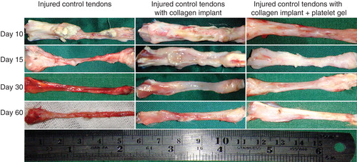 Figure 8. Gross morphologic features of the injured tendons at various stages of tendon healing. Note that no tendinous tissue has been formed in the ICTs (no implant), while a tendon has been formed in those groups treated with collagen and collagen-platelet scaffolds. Compared to the CI alone, treatment with the collagen-platelet implant considerably increased the rate of implant absorption and matrix replacement, it also improved the surface quality, fibrous density and reduced hyperemia and tendon adhesion to the surrounding structures. Bovine platelet also reduced muscle atrophy and fibrosis compared to the controls.