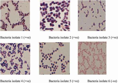 Figure 1. Gram staining reactions of the bacteria isolates (+ve = positive and -ve = negative) from high-quality cassava flour (HQCF) from Lusaka markets