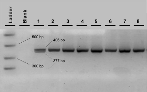 Figure 4 Agarose electrophoresis result of the TLR4 Thr399Ile PCR-RFLP genotyping method.
