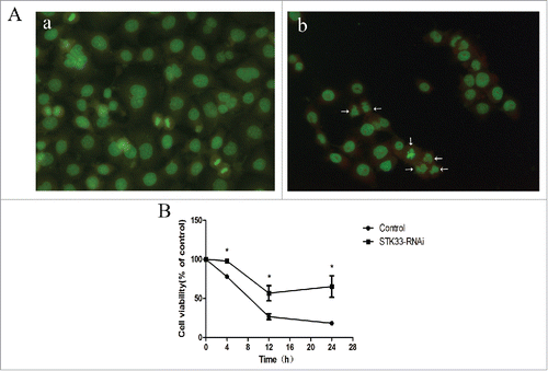 Figure 4. Effects of STK33-RNAi and Ionomycin on Fadu cells and in vitro cell function test. (A) Induction of apoptosis in Fadu cells by Ionomycin as assessed by AO staining. a) control, b) treated with Ionomycin for 6h. (B) Decrease in cell viability by Ionomycin appeared in time-manner. STK33-RNAi group had higher cell viability than the control group. Data represent the mean ± SEM, *p < 0 .05.