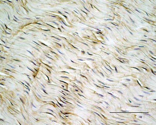 Figure 5. Microscopic longitudinal section of a normal tendon (K). Immunohistochemical localization of COMP. Note the staining in the normally aligned fibers. K refers to tendon ID (see Tables 1 and 2). Bar = 100 μm.