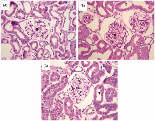 Figure 5. Histology of representative glomeruli at 40X magnification from control rats (A), rats given atherogenic diet (B) and TRF-treated rats (C). Jones PAS-stained glomeruli show expanded mesangium, widening of matrix in atherogenic experimental groups relative to control. The treatment with TRF reduced the widening of matrix and mesangial expansion as compared to untreated rats.