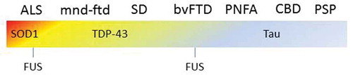 Figure 4. FTD forms a clinical with motor neuron diseases as well as with movement disorders, such as CBD and PSP. The underlying pathology and underlying genetics are equally heterogeneous. This example illustrate how challenging it can be to classify diseases with heterogeneous which form a spectrum. ALS = amyotrophic lateral sclerosis, mnd-ftd = motor neuron disease frontotemporal dementia, SD = semantic dementia, bvFTD = behavioral variant frontotemporal dementia, PNFA = progressive non-fluent aphasia, CBD = corticobasal degeneration, PSP = progressive supranuclear palsy.