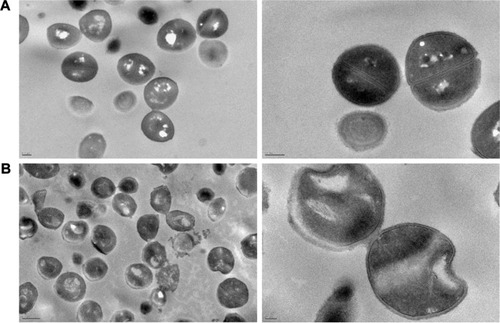 Figure 4 Transmission electron microscope images of MSSA ATCC strain untreated control (A) and treated with 3.2 mg/mL (32× MIC) of ML-LNCs (B) for 1 hour. Scale bars: (A) left: 0.2 µm, right: 0.2 µm; (B) left: 0.5 µm, right: 100 nm.Abbreviations: MIC, minimum inhibitory concentration; ML-LNCs, monolaurin-lipid nanocapsules; MSSA, methicillin-susceptible Staphylococcus aureus.