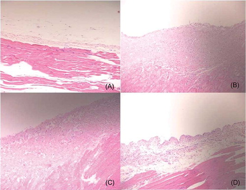 Figure 2.  Histologic features of the parietal peritoneum (hematoxylin-eosin, magnification ×200). (A) The intact thin mesothelial layer of the peritoneum overlies muscle in the control group. (B) Chlorhexidine significantly increased thickness, cellularity (inflammation), and fibrotic changes. (C) Peritoneal rest had no morphologic benefits; increased vascularity, thickness, and fibrosis are also shown in the resting group. (D) Imatinib treatment group is characterized by reduced cellularity (inflammation).