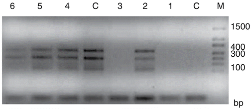 Figure 4.  Bcl-2 expression of HeLa cells (M, Marker; C, Control; 1, AMI; 2, DAU and 3, AMI+DAU for 24 h; C, Control; 4, AMI; 5, DAU and 6, AMI+DAU for 48 h).