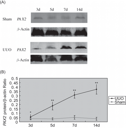 FIGURE 5. Western blotting analysis of PAX2 protein expression. (A) The expression of PAX2 and β-actin proteins in UUO and sham groups. (B) The ratio of PAX2 and β-actin proteins in UUO and sham groups.