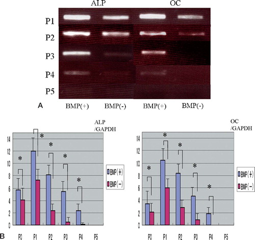 Figure 2. Electrophoresis of PCR products from real-time reverse transcriptase PCR analysis [OK?] of ALP and OC expression in cells at different passages (P0–P5), cultured with and without BMP-2 (A). The mRNA expression of ALP and OC was quantified as described in Material and methods (B). Data shown are the means (SEM) of 3 different samples, and were analyzed by unpaired Student’s t-test between the 2 groups (*p < 0.05). For passages P0–P4, the expression of mRNA for both osteogenic markers was significantly higher in the BMP(+) group than in the BMP(-) group (n = 3).