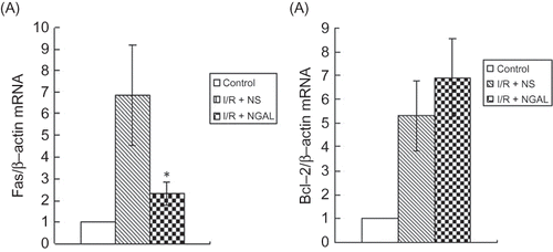 Figure 3. The mRNA levels of (A) Fas and (B) Bcl-2 in the kidney at the end of 48 h of reperfusion. *p < 0.05, versus I/R + NS group.