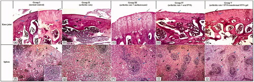 Figure 4. Photomicrographs of articular cartilage and splenic parenchymae of different sections in different groups (H&E ×100). (a–e) Articular cartilage of different groups. (a) Normal control rat section showing a smooth articular surface (black arrow) and a regular tide mark (blue arrow) separating the articular cartilage from the underlying subchondral bone. (b) Arthritis control rat section showing disrupted articular surface (black arrow), cartilage layer was thinner with cell loss, cell cloning and multicellular chondrocyte clusters and overall the cells appeared in a less ordered structure (blue arrow). The subchondral bone invaded the calcified cartilage (stars), top right. (c) Methotrexate-treated arthritic rat section showing slight smooth articular surface (black arrow), thickened articular cartilage with proliferating chondrocytes (blue arrow), hypercellularity and cloning. Regular tide mark can be seen (arrowhead). (d) Oral FVS-treated arthritic rat section showing slightly smooth articular surface (blue arrow) with thinner articular cartilage layer. The subchondral bone (star) can be observed. The proliferating chondrocytes showing hypercellularity, cloning, and slightly ordered distribution (black arrow). Regular tide mark can be seen (arrowhead). (e) FVS-loaded SNVs gel-treated arthritic rat section showing smooth articular surface (black arrow). Thickened articular cartilage and subchondral bone (star) can be observed. The proliferating chondrocytes showing hypercellularity, cloning, and slightly ordered distribution (blue arrow). Regular tide mark can be seen (arrowhead). (f–j) Splenic parenchymae of different sections. (f) Normal control rat section showing thin capsule (arrowhead), trabeculae (black arrow) and white pulp formed of lymphatic follicles (blue arrow) surrounded with red pulp (stars). Inserted box showing lymphatic follicles with central arteriole and well-defined marginal zone. (g) Arthritis control rat section showing marked atrophy of white pulp (black arrow) and red pulp (stars). (h) Methotrexate-treated arthritic rat section showing proliferating lymphatic follicles (white pulp) (blue arrow) surrounded with hyperplastic red pulp (black arrow). Lymphatic follicles showing central arteriole (arrowhead) and well-defined marginal zone. (i) Oral FVS-treated arthritic rat section showing slightly proliferating lymphatic follicles (white pulp) (blue arrow) surrounded with hyperplastic red pulp (black arrow). Lymphatic follicles showing central arteriole and well-defined marginal zone. (j) FVS-loaded SNVs gel-treated arthritic rat section showing slightly proliferating lymphatic follicles (white pulp) (blue arrow) surrounded with hyperplastic red pulp (black arrow). Lymphatic follicles showing central arteriole and well-defined marginal zone.