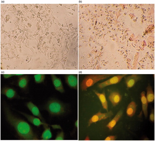 Figure 8. Cytotoxicity (a) Untreated, (b) treated MDA-MB-231 cells at 48 h, (c) Live cells (AO-Et-Br staining), and (d) damaged cells.
