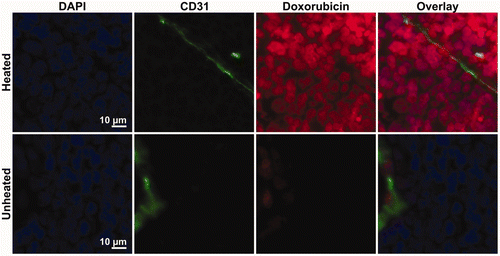 Figure 6. Accumulation of doxorubicin in the cells of heated and unheated tumours following administration of thermosensitive liposomal doxorubicin. In 40× images of the heated tumour, doxorubicin fluorescence (red) demonstrates co-localisation with DAPI staining of cell nuclei (blue) outside of the CD31-stained blood vessels (green). In the unheated tumour, doxorubicin fluorescence was limited to perivascular regions; low levels of doxorubicin fluorescence in the tumour interstitium could not be distinguished from the background.