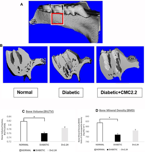 Figure 1 Morphometric analysis of diabetes-induced osteoporosis measured by μCT. (A). The total volume of interest (VOI) area indicated in the white box. And the bone volume of interest area indicated in the red box. (B). Morphometric imaging shows the porosity of maxillary bone surface was obviously increased in diabetic rats in comparison with normal control and D+CMC2.24 treated rats. (C). The analysis of bone volume fraction (BV/TV) by μCT. VOX: based on counting voxels; TV: total volume (mm3); BV: bone volume (mm3). (D). The analysis of bone mineral density (BMD) by μCT based on calculating the units of hydroxyapatite density (mg HA/cm3). White bar: N, normal group; Black bar: D, diabetic group; Gray bar: D+CMC2.24, diabetes+CMC2.24 treatment group. Each value represents Mean (n=6/group) ± Standard Error (S.E.M.) *Indicates p<0.05 values compared between groups at the same time period.