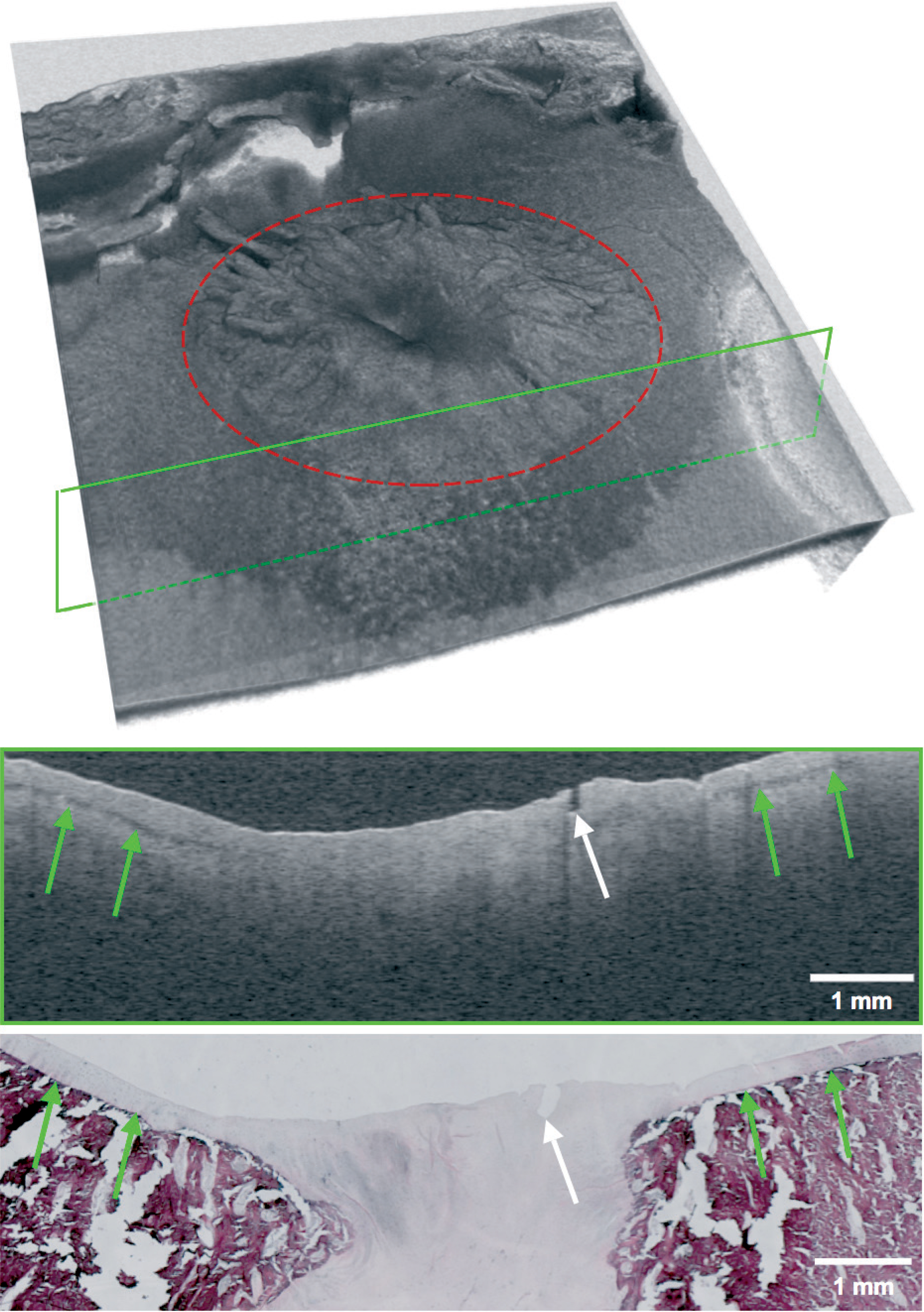Figure 1. View of a typical OCT dataset consisting of 300 slices with corresponding single OCT slice (top) and matched histopathology slide (bottom). The site of the osteochondral defect is marked in red and the location of the OCT slide is marked with a green frame. Landmark properties such as small fissures (white arrow) and the transitional zone between cartilage and subchondral zone (green arrows) are identified in both modalities.