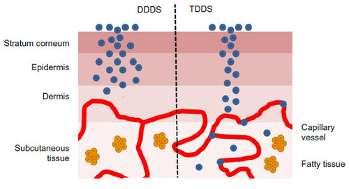 Figure 2 Dermal drug delivery systems and transdermal drug delivery system.