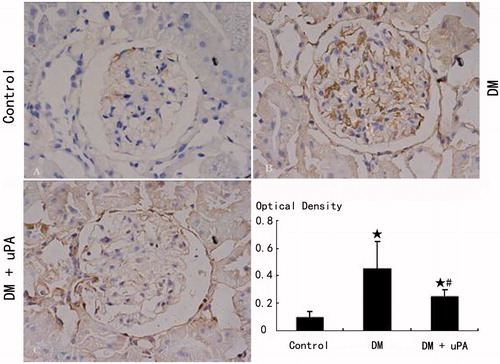 Figure 6. Glomerular collagen IV expression in rats of the three groups (IHC × 480). (A) Control group. (B) Diabetic (DM) group. (C) Diabetes treated with uPA (DM + uPA) group. ☆p < 0.01, compared with control group. #p < 0.01, compared with diabetic rat group.