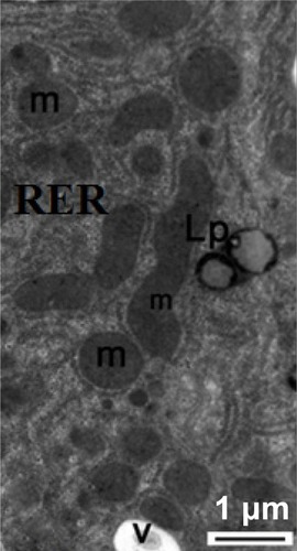 Figure 17 Transmission electron micrograph of a hepatic cell from the treated group showing some lipofuscin pigment, fragmented cisternae in the rough endoplasmic reticulum, and small membranous vesicles. Note the mitochondria. Scale bar 1 μm.Abbreviations: Lp, lipofuscin pigment; m, mitochondria; RER, rough endoplasmic reticulum; v, membranous vesicles.