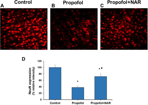 Figure 5 Neuronal nucleus (NeuN) expression analysis in cortical brain section of adult mice. (A) control group; (B) propofol treatment group; (C) propofol+naringenin. (D) Quantitative expression of NeuN expression. *P<0.05 versus control group; #P<0.05 versus propofol group.