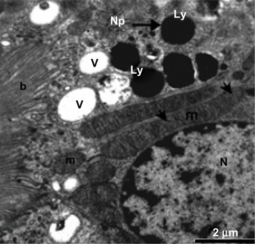 Figure 8 Higher magnification of the previous micrograph showing the nucleus, well developed mitochondria, and membranous vesicles, as well as lysosomes containing electron-dense nanoparticles (thick arrows). Note that some mitochondrial cristae are destroyed (thin arrows). Scale bar 2 μm.Abbreviations: b, brush border; Ly, lysosomes; m, mitochondria; N, nucleus; Np, nanoparticles; V, membranous vesicles.