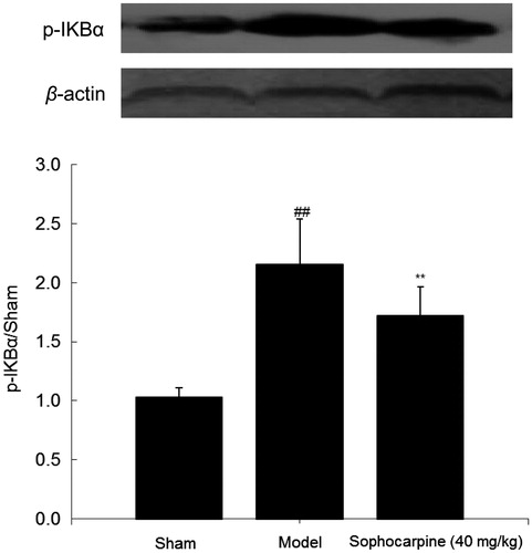 Figure 6. Effects of sophocarpine on p-IKBα expression. Western blot analysis of p-IKBα expression. Values are reported as the mean ± SD. Significance was determined by ANOVA followed by Tukey’s test. ##p < 0.01 compared with the sham group; **p < 0.01 compared with the model group.