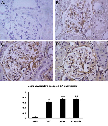 Figure 3.  Representative photographs of immunohistochemistry for fibronectin. In renal ablation rats, fibronectin was observed slightly in the glomerular mesangium and the renal interstitium (B). However, in rats that received aldosterone infusion, renal injury was associated with increases in the numbers of fibronectin-positive (C and D) cells in the glomerular mesangium and the renal interstitium. There was no significant difference between aldosterone DMA-treated rats and the rats that were treated with aldosterone alone (C and D). A: SHAM group; B: SNX group; C: ALDO group; D: ALDO+DMA group. *p < 0.01 versus SHAM group; **p < 0.05 versus SNX group. Magnification: ×400.