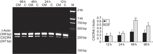FIGURE 6. Effect of CM on mRNA expression of CXCR4 production. RT-PCR: production of CXCR4 by EPCs in CM group was significantly greater than that in control group, and reached the maximum at 48 h. C (control group): conditioned medium from normoxic condition; CM: conditioned medium from hypoxic condition; β-actin was used as a housekeeping gene. Data are presented as the mean ± SD. n = 5. *p < 0.05, **p < 0.01 compared with control group.