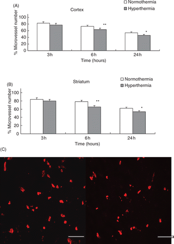 Figure 3. (A) The reduction of the number of collagen type IV positive stain microvessels in the cortex. The microvessel numbers are expressed as percentage changes between the ipsilateral and contralateral hemispheres to the occluded MCA. *p < 0.01, **p < 0.001 compared with the normothermic group. (B) Number of collagen type IV positive stain microvessels in the striatum. *p < 0.01, **p < 0.001 compared with the normothermic group. (C) Representative photomicrographs show microvessels stained by Cy™3-conjugated anti-type IV collagen at 24 h after MCA occlusion in the cortex. Left panel: normothermic and right panel: hyperthermic (scale bar = 200 µm).