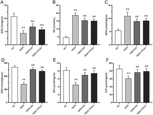 Figure 5. Effects of DG on renal oxidant and antioxidant levels in MGN rats. (A) SOD, (B) NO, (C) MDA, (D) GSH, (E) GPx, (F) CAT. Data are expressed as the mean ± standard deviation (SD), n = 3. ##p < 0.01 vs. NC group. **p < 0.01 vs. MGN group. SOD: superoxide dismutase; NO: nitric oxide; MDA: malondialdehyde; GPx: glutathione peroxidase; CAT: catalase; NC: normal control; MGN: membranous glomerulonephritis; DG: diosgenin; TPCA1: [(aminocarbony)amino]-5-(4-fluorophenyl)-3-­thiophenecarboxamide.