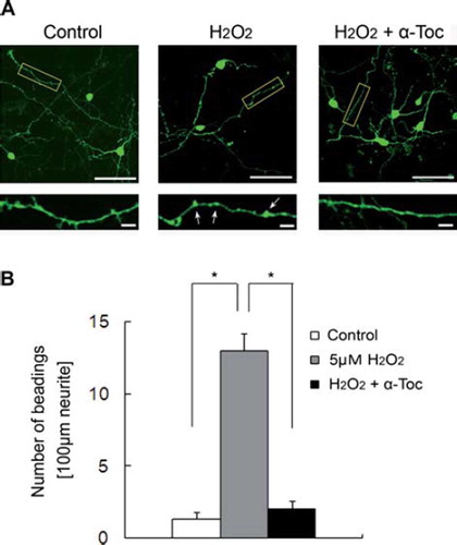 Figure 6. Neurite beading was induced by treatment of EGFP-transfected CGCs with hydrogen peroxide. (A) Each image was taken by confocal microscopy. After 18 h of transfection with EGFP, the CGCs were treated with 5 μM hydrogen peroxide in the presence or absence of 10 μM α-tocopherol. Magnified images represent the regions defined in the yellow box of each fluorescence photomicrograph. Arrows show beading along the neurites. The scale bar is 50 μm (upper panels) or 10 μm (lower panels). (B) The results of quantitative analysis of neurite beading in hydrogen peroxide-treated CGCs. Each column represents the mean of three independent experiments. Data were analysed by Student's t-test, with findings of p < 0.01 considered significant. The method of transfection is described in Materials and methods.