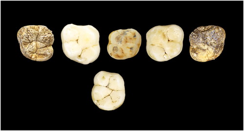 Figure 4. E-JUV individual #2. Top row (left to right): Left maxillary M2, M1; right dm2, M1, M2. Bottom row: mandibular left M1.
